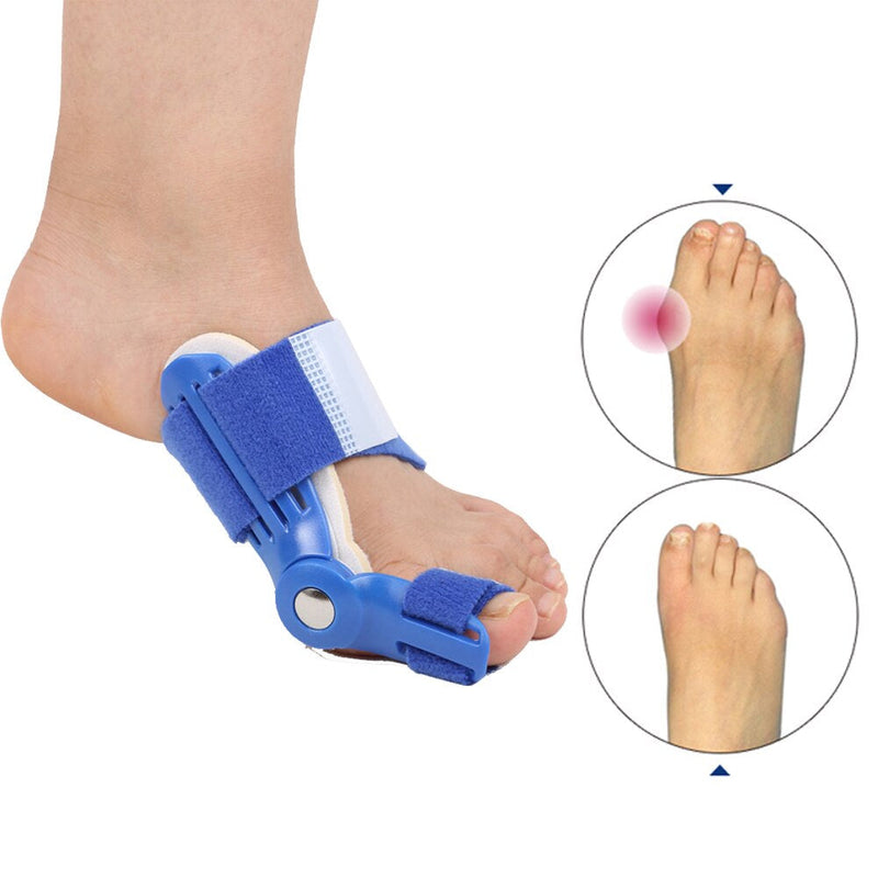 ZanBunion™ Orthopedic Bunion Corrector (1 Pair)