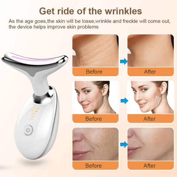 Face llift with microstron EMS wrinkle removal Zanmassage!